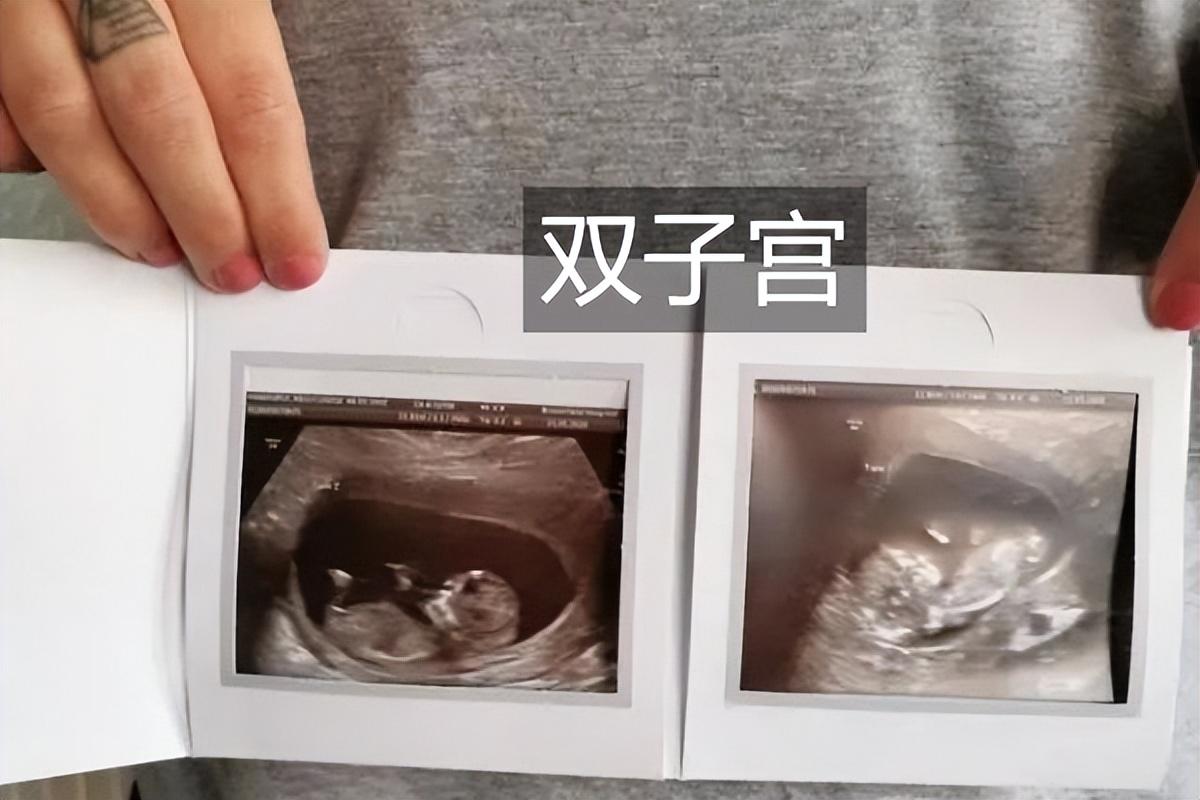 新澳门全年免费资料，详细解答、深度解答解释落实