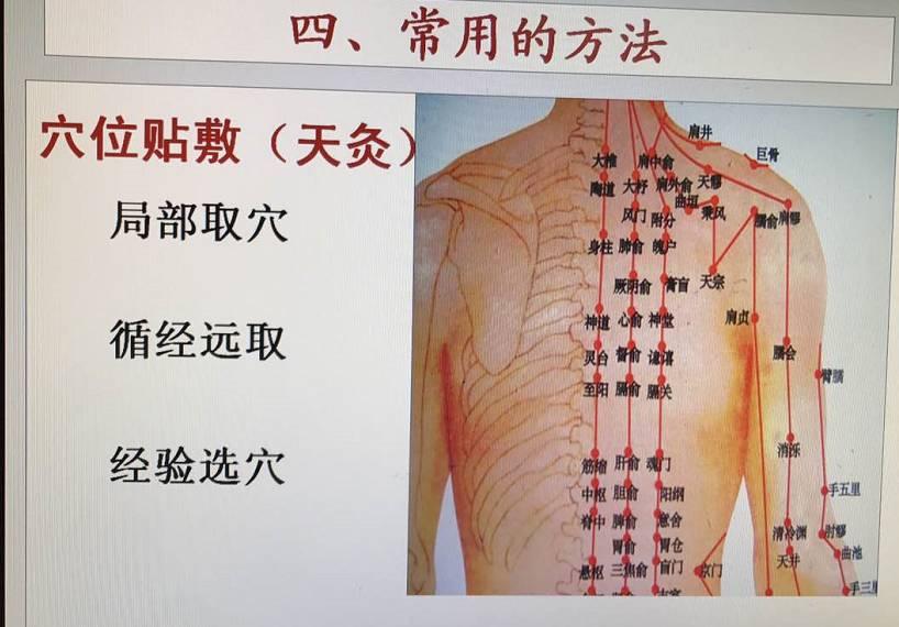 2025新奥门精准正版免费大全，详细解答、构建解答解释落实