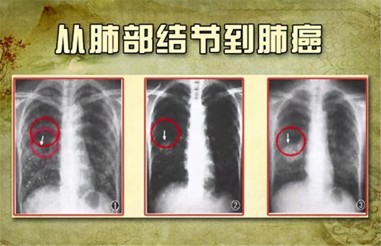 新澳门精准单双期期准!详细解答、科学解答解释落实